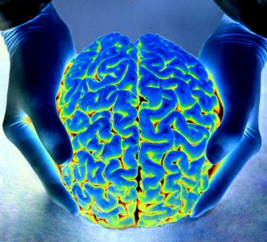 Brain changes